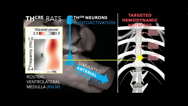 Aaron Phillips | Techniques for Understanding Neural Hemodynamic Control