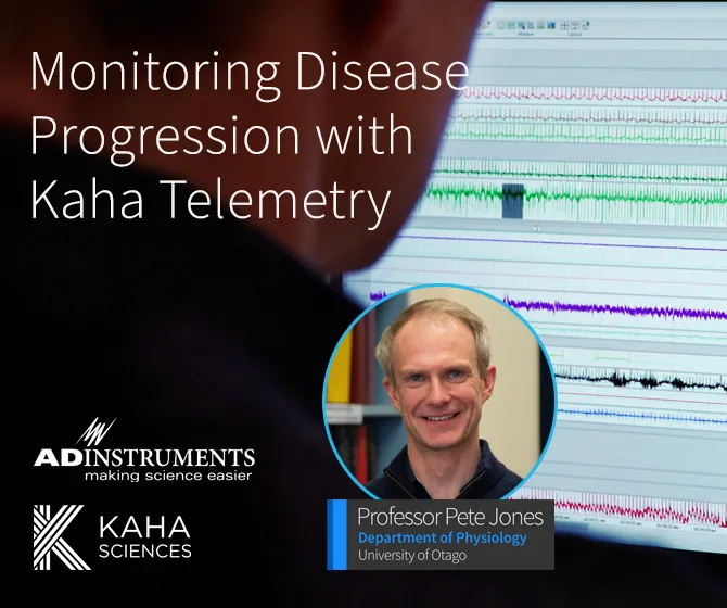 A view from behind a person sitting at a computer, their screen has physiological recording data. 