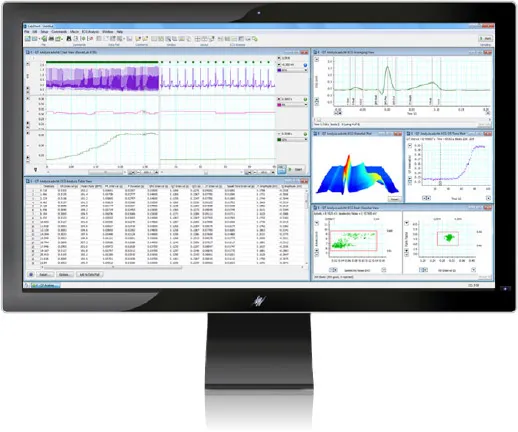 ECG Analysis LabChart Software