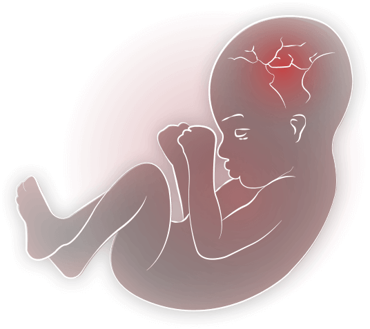 Baby in womb