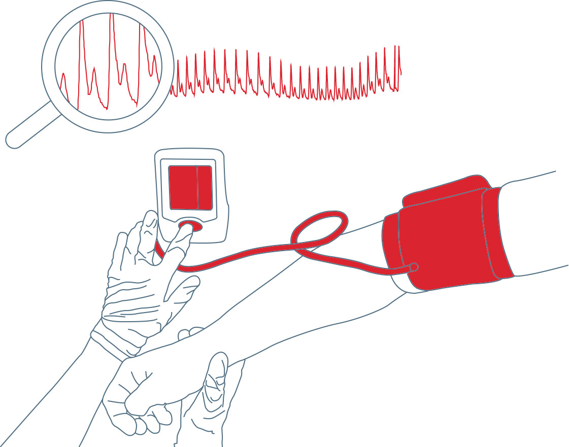 Blood pressure